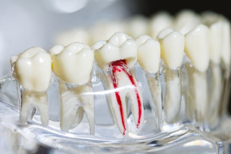 รากฟัน – ส่วนสำคัญที่ซ่อนอยู่ใต้เหงือก